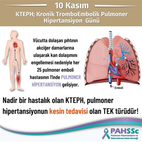 pulmoner hipertansiyon 2018